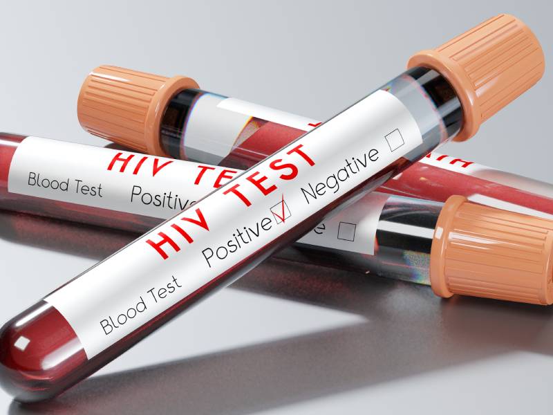 HIV  (ELISA Testi)